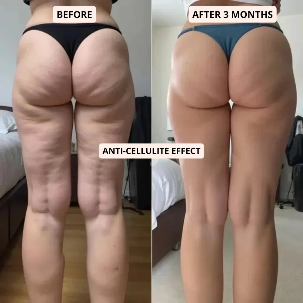 3D Sculpting Anti Cellulite Shorts